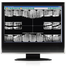 Dental Digital X-Rays in Cranbury, NJ